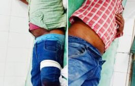 मुठभेड़ में दो बदमाश गिरफ्तार, एक पुलिस कर्मी भी घायल, आलापुर थाना क्षेत्र की घटना