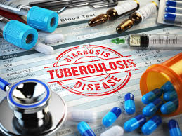 टीबी मरीजों को गोद लेने वालों का निक्षय पोर्टल पर होगा पंजीकरण,	ओपीडी में कुल आने वाले मरीजों में से 5ः की होगी टीबी जांच, मुख्यमंत्री स्वास्थ्य मेलों में अनिवार्य रूप से लगे टीबी का स्टाल